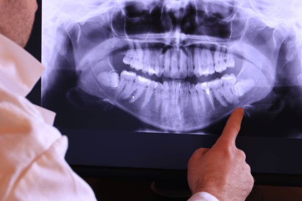 Best Dentist for Tooth Abscess  in Kingstown, MD
